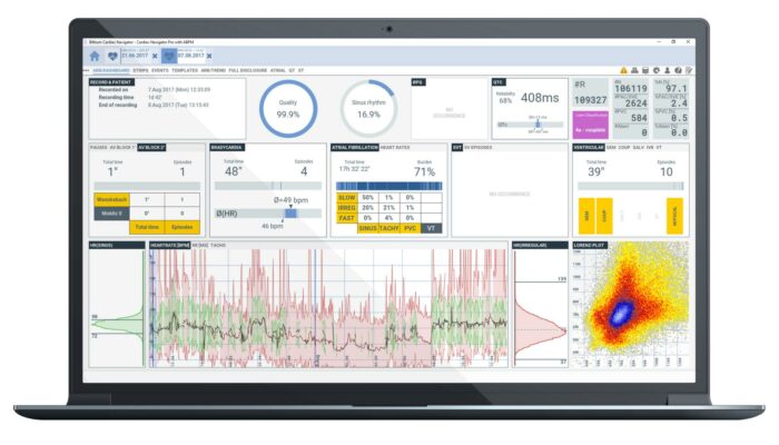 Interface du logiciel Bittium Cardiac Navigator pour l’analyse Holter ECG